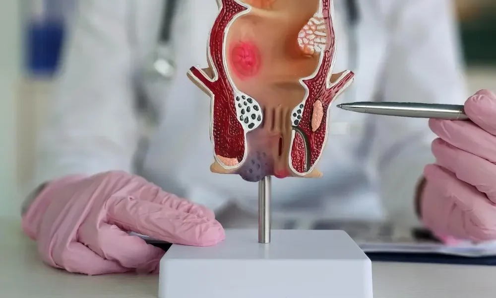 Piles Surgery in Vejalpur Ahmedabad - Akshar Hospital